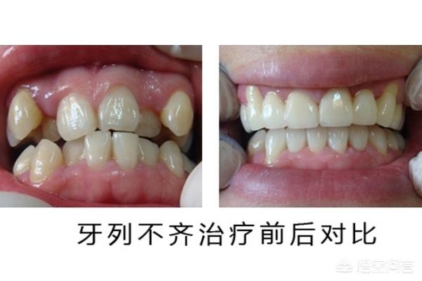 攀枝花最新24小时牙医在线咨询方法分析(最方便真实的攀枝花有没有24小时牙医方法)