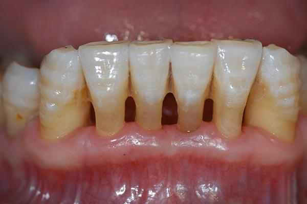 攀枝花最新24小时牙医在线咨询方法分析(最方便真实的攀枝花有没有24小时牙医方法)